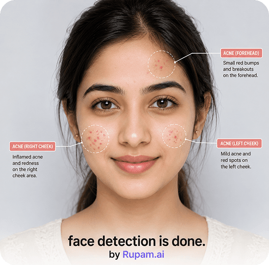 Bhartiya skin dataset visual