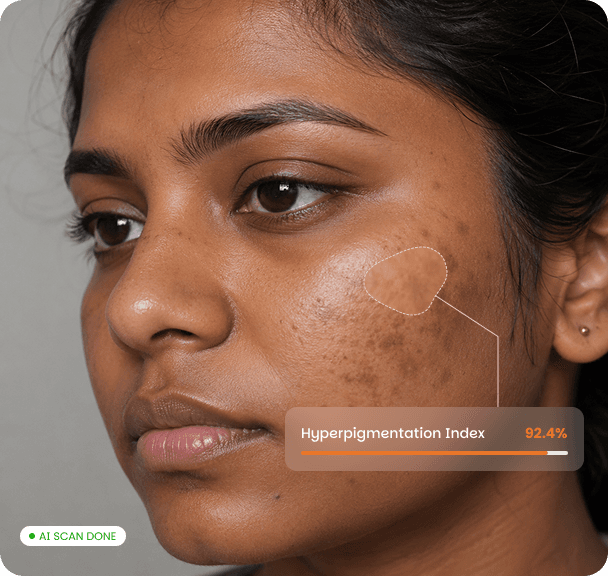 AI skin analysis — Hyperpigmentation Index 92.4%