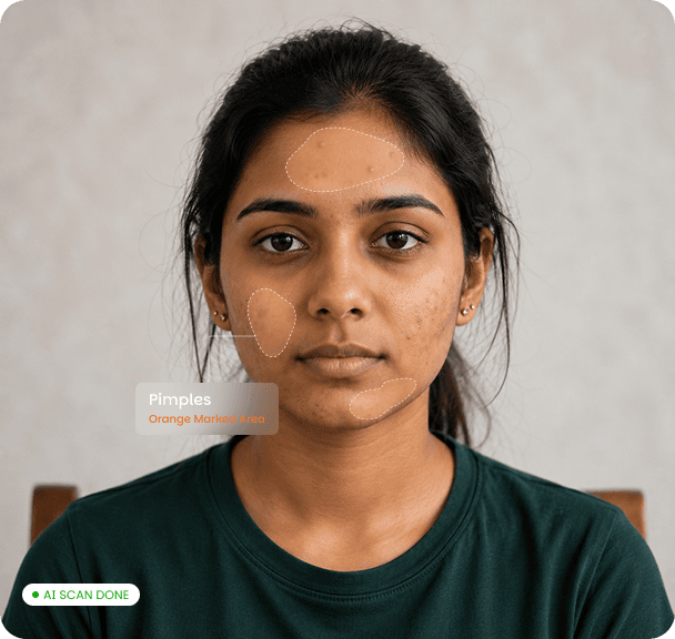 AI skin analysis — Pimples detection