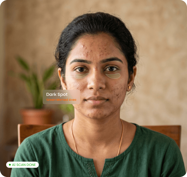 AI skin analysis — Dark Spot detection