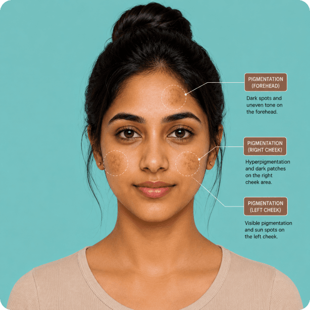 Rupam.ai skin analysis API preview on Bhartiya skin